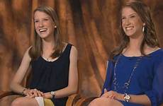 conjoined copeland caitlin valedictorians separated