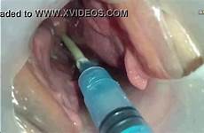 sperm uterus into xnxx injected