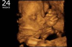 ultrasound 24 3d week pregnancy baby weeks pregnant 24th development symptoms details during