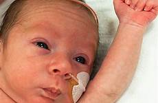 baby preemie premature milestones stages developmental healthychildren growth