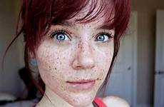 freckled freckledgirls