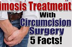 phimosis circumcision treatment surgery foreskin tight