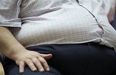 fat man obese obesity overweight weight disgusting over morbid old guardian