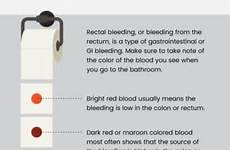 bleeding rectal constipation axe poop hemorrhoids draxe conventional pooping