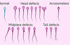 morphology sperm analysis semen normal types range meaning amount invitra leukocytes imagen