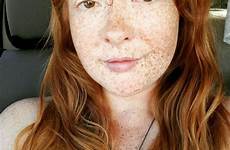 freckles redheads daniyal