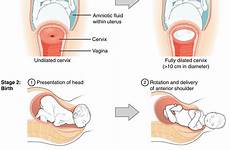 childbirth stages birth labor dilation delivery pregnancy during women stage afterbirth early changes bottom cervical