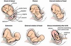 cephalic presentation vertex labour fetal britannica fasen bevalling parturition ubun phases inwendige childbirth stages bayi head womb flexion rotation pelvis