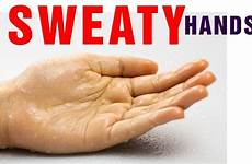 sweaty palms cure rid