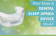 sleep apnea dental device work does