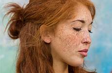 freckles redheads portraits scotland dowling