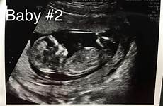 scan skull gender weeks nub ultrasound baby guesses based theories prediction current face