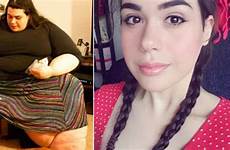 year old obese 400 woman life pounds morbidly abrozzi