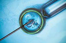 icsi sperm injection intracytoplasmic fertility ivf