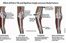 knee locked posture postural pain hips hip back joint body leg lower mechanics movement fix standing neck position good pelvic