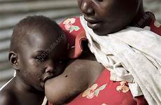 breastfeeding child uganda