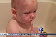 toddler abuse oregon abused
