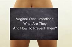 yeast infections discharge causes prevent