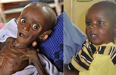 starving african child famine gedi farah poster