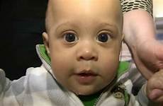 pacifier baby doctors raced swallowed who save