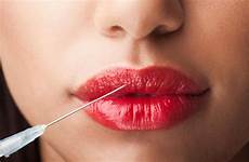 lip augmentation injections lips surgery allure stock human procedure master introduction similar