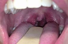 throat sore dentists depending