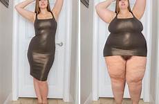 gain fat wg morph breast celulitis