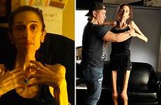 rachael anorexia farrokh anorexic woman after treatment thanks raising donors nearly 200k still supporters severe disorders eating who her actress