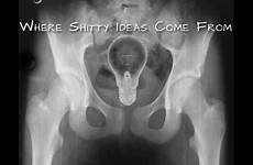 rays bizarre amazing ray ass inserted object random funny found into objects places items lesbian weird stuffing things dumpaday xray