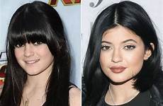 kylie jenner before lips famous she shocking kardashian years theinfong transformation dramatic over after mirror pout star has