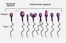 semen sperm abnormal male analysis normal