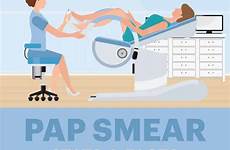 pap smear cervical screening papsmear draxe importance