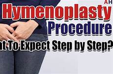 surgery hymenoplasty procedure hymen repair during