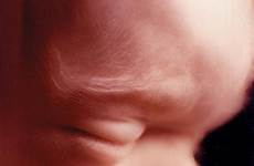 parentune ultrasound fetal progress