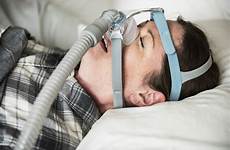 apnea obstructive steadyhealth reduction radiofrequency turbinate throat