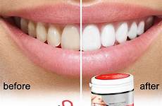 whitening natural charcoal teeth activated powder