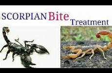 bite scorpian treatment