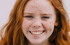 ginger freckles hair scottish teenager smiling