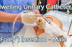 catheter foley male urinary indwelling insertion