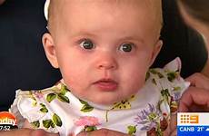 baby girl goldie deaf hears say time six parents very her first hearing implants fitted shepherd absolutely cochlear months thursday