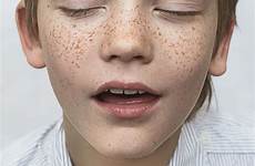 freckles serov vladimir freckle extasis boredpanda