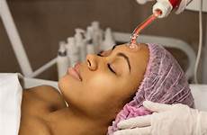 electrotherapy facials acupuncture sha gua frequency ray cochrane