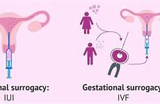 surrogacy gestational between surrogate