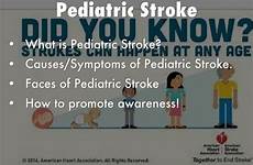 pediatric stroke