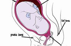 childbirth positions questioning womb fetus pelvis