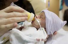 premature baby milk feeding infants formula human breastfeeding birth