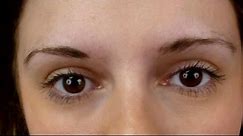Women Turn to Eyebrow Transplants for Fuller Brows