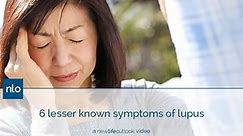 6 Lesser Known Symptoms of Lupus