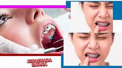 Dauus Health - Oral pain relief: waxa lagu talagalay inay...