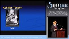 RSNA 2013 - Advances in MSK Imaging with ShearWave™ Elastography by Dr. Kenneth Lee